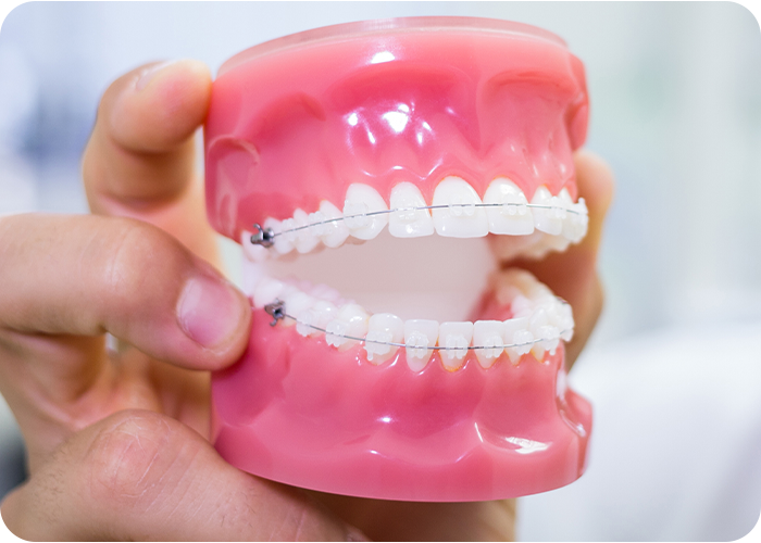 service 5 dentures doctor shahzeb patoli dentist in islamabad