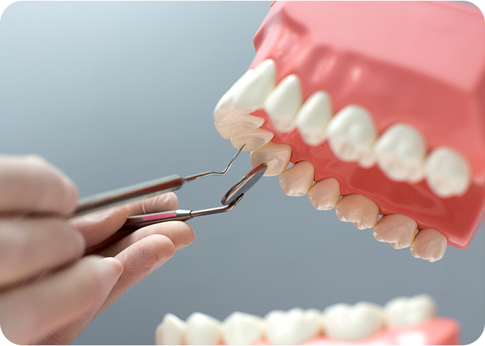 service 6 crown & bridges doctor shahzeb patoli dentist in islamabad