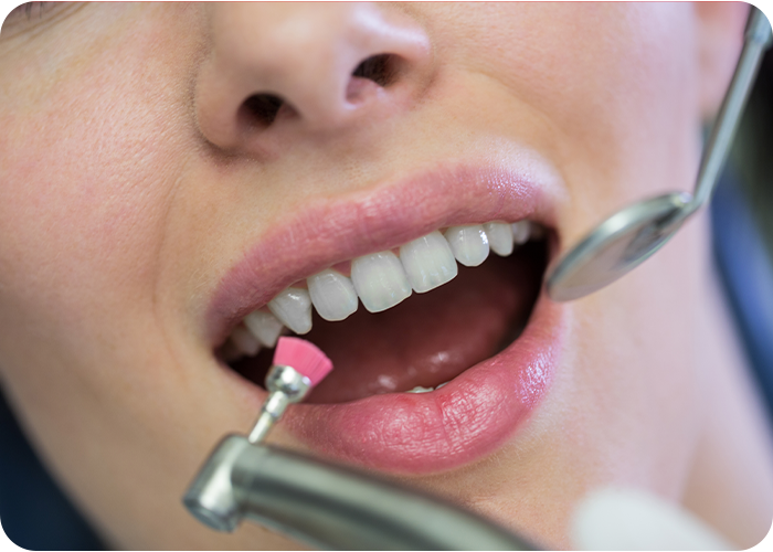 service 7 crown & bridges doctor shahzeb patoli dentist in islamabad